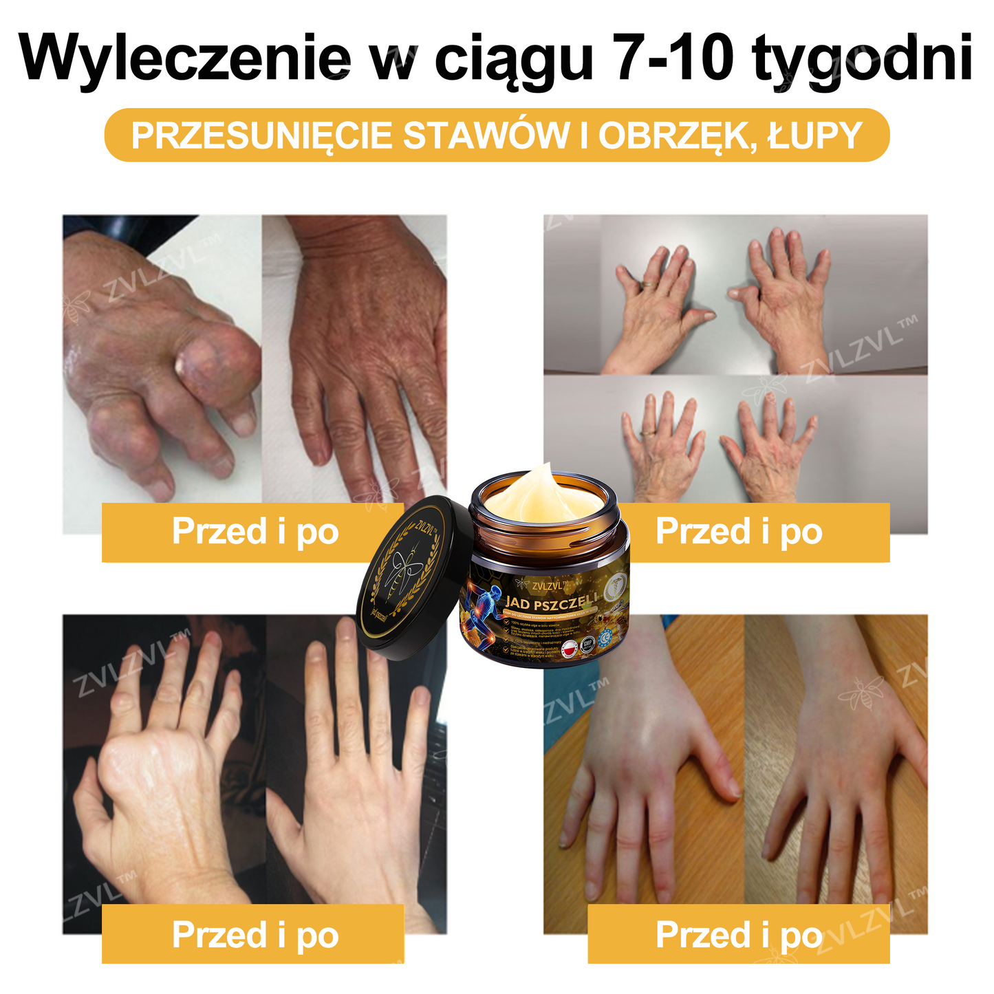 𝐎𝐟𝐢𝐜𝐣𝐚𝐥𝐧𝐲 𝐬𝐤𝐥𝐞𝐩: 𝐙𝐕𝐋𝐙𝐕𝐋™ 𝐊𝐫𝐞𝐦 𝐳 𝐣𝐚𝐝𝐞𝐦 𝐩𝐬𝐳𝐜𝐳𝐞𝐥𝐢𝐦 𝐍𝐚𝐭𝐲𝐜𝐡𝐦𝐢𝐚𝐬𝐭𝐨𝐰𝐲 𝐔𝐥𝐭𝐫𝐚 𝐌𝐨𝐜𝐧𝐲 Ś𝐫𝐨𝐝𝐞𝐤 𝐏𝐫𝐳𝐞𝐜𝐢𝐰𝐛ó𝐥𝐨𝐰𝐲 - 🧑‍⚕️🧑‍⚕️(Ł𝐚𝐠𝐨𝐝𝐳𝐢 𝐛ó𝐥 𝐰 𝐩𝐫𝐳𝐲𝐩𝐚𝐝𝐤𝐮 𝐳𝐚𝐩𝐚𝐥𝐞𝐧𝐢𝐚 𝐬𝐭𝐚𝐰ó𝐰, 𝐛ó𝐥𝐮 𝐦𝐢ęś𝐧𝐢, 𝐛ó𝐥𝐮 𝐩𝐥𝐞𝐜ó𝐰, 𝐤𝐨𝐥𝐚𝐧, 𝐩𝐥𝐞𝐜ó𝐰, 𝐫𝐚𝐦𝐢𝐨𝐧, 𝐛𝐢𝐨𝐝𝐞𝐫, 𝐧𝐚𝐝𝐠𝐚𝐫𝐬𝐭𝐤ó𝐰, 𝐝ł𝐨𝐧𝐢)