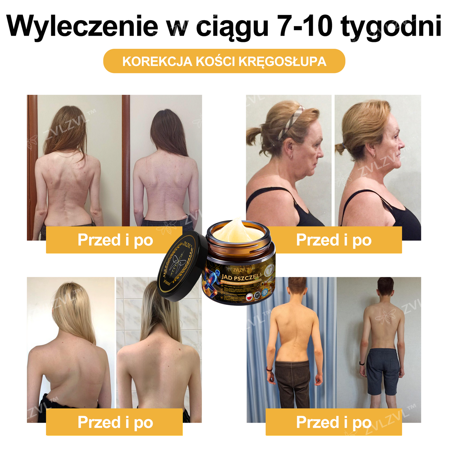 𝐎𝐟𝐢𝐜𝐣𝐚𝐥𝐧𝐲 𝐬𝐤𝐥𝐞𝐩: 𝐙𝐕𝐋𝐙𝐕𝐋™ 𝐊𝐫𝐞𝐦 𝐳 𝐣𝐚𝐝𝐞𝐦 𝐩𝐬𝐳𝐜𝐳𝐞𝐥𝐢𝐦 𝐍𝐚𝐭𝐲𝐜𝐡𝐦𝐢𝐚𝐬𝐭𝐨𝐰𝐲 𝐔𝐥𝐭𝐫𝐚 𝐌𝐨𝐜𝐧𝐲 Ś𝐫𝐨𝐝𝐞𝐤 𝐏𝐫𝐳𝐞𝐜𝐢𝐰𝐛ó𝐥𝐨𝐰𝐲 - 🧑‍⚕️🧑‍⚕️(Ł𝐚𝐠𝐨𝐝𝐳𝐢 𝐛ó𝐥 𝐰 𝐩𝐫𝐳𝐲𝐩𝐚𝐝𝐤𝐮 𝐳𝐚𝐩𝐚𝐥𝐞𝐧𝐢𝐚 𝐬𝐭𝐚𝐰ó𝐰, 𝐛ó𝐥𝐮 𝐦𝐢ęś𝐧𝐢, 𝐛ó𝐥𝐮 𝐩𝐥𝐞𝐜ó𝐰, 𝐤𝐨𝐥𝐚𝐧, 𝐩𝐥𝐞𝐜ó𝐰, 𝐫𝐚𝐦𝐢𝐨𝐧, 𝐛𝐢𝐨𝐝𝐞𝐫, 𝐧𝐚𝐝𝐠𝐚𝐫𝐬𝐭𝐤ó𝐰, 𝐝ł𝐨𝐧𝐢)