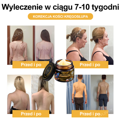 𝐎𝐟𝐢𝐜𝐣𝐚𝐥𝐧𝐲 𝐬𝐤𝐥𝐞𝐩: 𝐙𝐕𝐋𝐙𝐕𝐋™ 𝐊𝐫𝐞𝐦 𝐳 𝐣𝐚𝐝𝐞𝐦 𝐩𝐬𝐳𝐜𝐳𝐞𝐥𝐢𝐦 𝐍𝐚𝐭𝐲𝐜𝐡𝐦𝐢𝐚𝐬𝐭𝐨𝐰𝐲 𝐔𝐥𝐭𝐫𝐚 𝐌𝐨𝐜𝐧𝐲 Ś𝐫𝐨𝐝𝐞𝐤 𝐏𝐫𝐳𝐞𝐜𝐢𝐰𝐛ó𝐥𝐨𝐰𝐲 - 🧑‍⚕️🧑‍⚕️(Ł𝐚𝐠𝐨𝐝𝐳𝐢 𝐛ó𝐥 𝐰 𝐩𝐫𝐳𝐲𝐩𝐚𝐝𝐤𝐮 𝐳𝐚𝐩𝐚𝐥𝐞𝐧𝐢𝐚 𝐬𝐭𝐚𝐰ó𝐰, 𝐛ó𝐥𝐮 𝐦𝐢ęś𝐧𝐢, 𝐛ó𝐥𝐮 𝐩𝐥𝐞𝐜ó𝐰, 𝐤𝐨𝐥𝐚𝐧, 𝐩𝐥𝐞𝐜ó𝐰, 𝐫𝐚𝐦𝐢𝐨𝐧, 𝐛𝐢𝐨𝐝𝐞𝐫, 𝐧𝐚𝐝𝐠𝐚𝐫𝐬𝐭𝐤ó𝐰, 𝐝ł𝐨𝐧𝐢)