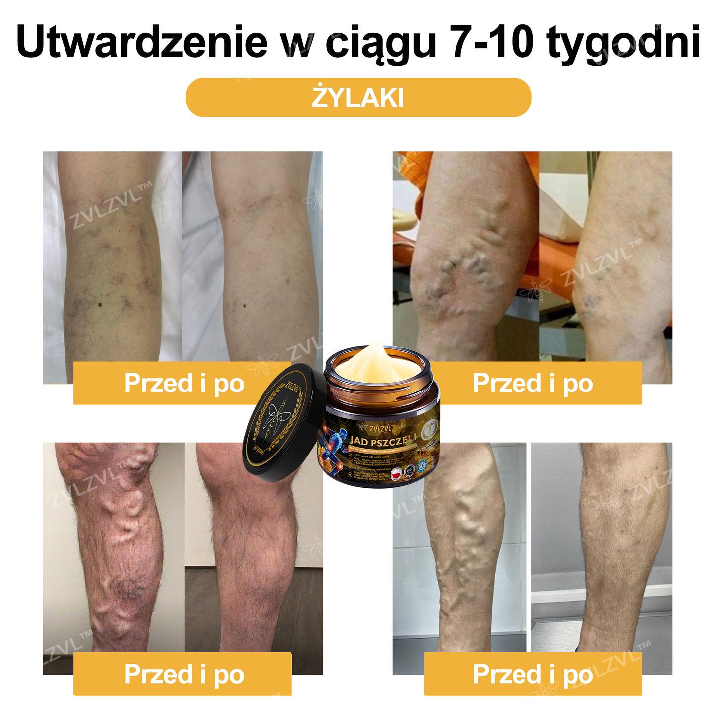 𝐎𝐟𝐢𝐜𝐣𝐚𝐥𝐧𝐲 𝐬𝐤𝐥𝐞𝐩: 𝐙𝐕𝐋𝐙𝐕𝐋™ 𝐊𝐫𝐞𝐦 𝐳 𝐣𝐚𝐝𝐞𝐦 𝐩𝐬𝐳𝐜𝐳𝐞𝐥𝐢𝐦 𝐍𝐚𝐭𝐲𝐜𝐡𝐦𝐢𝐚𝐬𝐭𝐨𝐰𝐲 𝐔𝐥𝐭𝐫𝐚 𝐌𝐨𝐜𝐧𝐲 Ś𝐫𝐨𝐝𝐞𝐤 𝐏𝐫𝐳𝐞𝐜𝐢𝐰𝐛ó𝐥𝐨𝐰𝐲 - 🧑‍⚕️🧑‍⚕️(Ł𝐚𝐠𝐨𝐝𝐳𝐢 𝐛ó𝐥 𝐰 𝐩𝐫𝐳𝐲𝐩𝐚𝐝𝐤𝐮 𝐳𝐚𝐩𝐚𝐥𝐞𝐧𝐢𝐚 𝐬𝐭𝐚𝐰ó𝐰, 𝐛ó𝐥𝐮 𝐦𝐢ęś𝐧𝐢, 𝐛ó𝐥𝐮 𝐩𝐥𝐞𝐜ó𝐰, 𝐤𝐨𝐥𝐚𝐧, 𝐩𝐥𝐞𝐜ó𝐰, 𝐫𝐚𝐦𝐢𝐨𝐧, 𝐛𝐢𝐨𝐝𝐞𝐫, 𝐧𝐚𝐝𝐠𝐚𝐫𝐬𝐭𝐤ó𝐰, 𝐝ł𝐨𝐧𝐢)