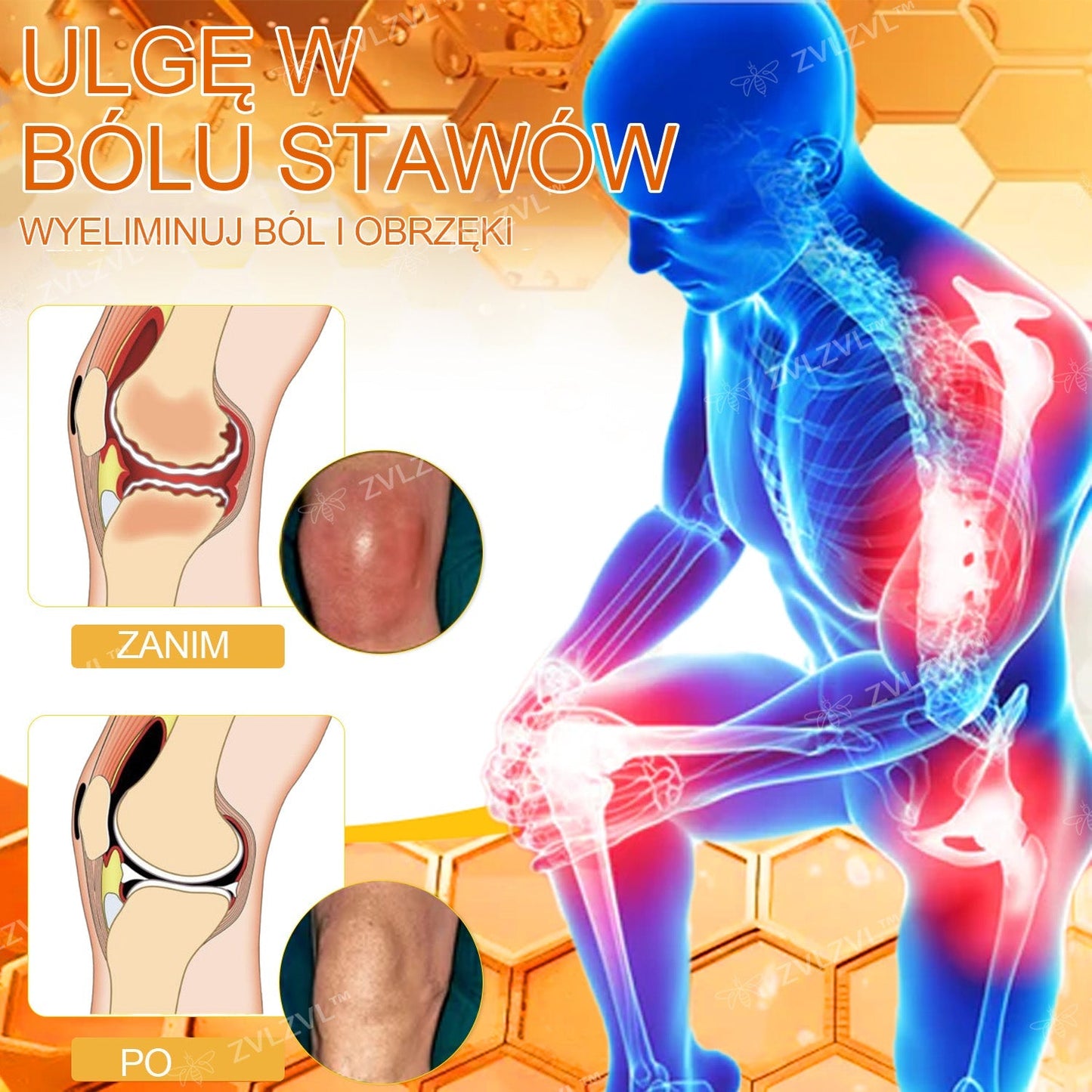 𝐎𝐟𝐢𝐜𝐣𝐚𝐥𝐧𝐲 𝐬𝐤𝐥𝐞𝐩: 𝐙𝐕𝐋𝐙𝐕𝐋™ 𝐊𝐫𝐞𝐦 𝐳 𝐣𝐚𝐝𝐞𝐦 𝐩𝐬𝐳𝐜𝐳𝐞𝐥𝐢𝐦 𝐍𝐚𝐭𝐲𝐜𝐡𝐦𝐢𝐚𝐬𝐭𝐨𝐰𝐲 𝐔𝐥𝐭𝐫𝐚 𝐌𝐨𝐜𝐧𝐲 Ś𝐫𝐨𝐝𝐞𝐤 𝐏𝐫𝐳𝐞𝐜𝐢𝐰𝐛ó𝐥𝐨𝐰𝐲 - 🧑‍⚕️🧑‍⚕️(Ł𝐚𝐠𝐨𝐝𝐳𝐢 𝐛ó𝐥 𝐰 𝐩𝐫𝐳𝐲𝐩𝐚𝐝𝐤𝐮 𝐳𝐚𝐩𝐚𝐥𝐞𝐧𝐢𝐚 𝐬𝐭𝐚𝐰ó𝐰, 𝐛ó𝐥𝐮 𝐦𝐢ęś𝐧𝐢, 𝐛ó𝐥𝐮 𝐩𝐥𝐞𝐜ó𝐰, 𝐤𝐨𝐥𝐚𝐧, 𝐩𝐥𝐞𝐜ó𝐰, 𝐫𝐚𝐦𝐢𝐨𝐧, 𝐛𝐢𝐨𝐝𝐞𝐫, 𝐧𝐚𝐝𝐠𝐚𝐫𝐬𝐭𝐤ó𝐰, 𝐝ł𝐨𝐧𝐢)