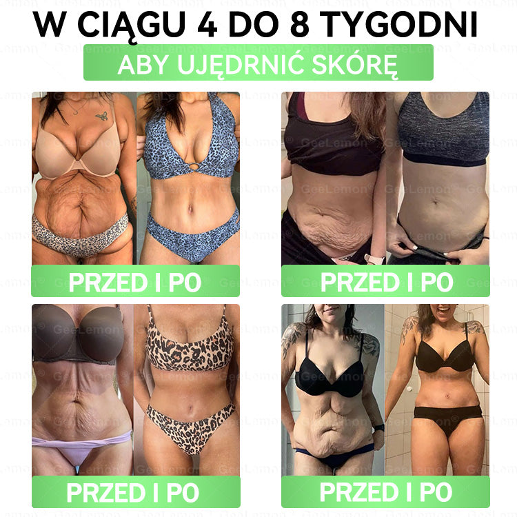 𝖮𝖋𝗶𝗰𝗷𝗮𝗹𝗻𝘆 𝘀𝗸𝗹𝗲𝗽  💪🍃| 𝐆𝐞𝑒𝐿𝑒𝐦𝐨𝐧® 𝐆𝐥𝐮𝐦ase𝐭𝐢𝐝𝐞 𝟖 𝐰 𝟏 Smukły i Zdrowy Nano Plaster z Mikronakłuciami 🇵🇱(Tylko raz dziennie, widoczne zmiany już w 7 dni),Wspiera odchudzanie, serce, cukrzycę, sen, jelita, stawy, a także ujędrnia skórę i dodaje energii